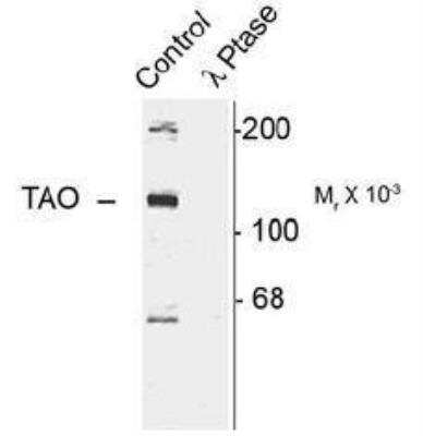 Western Blot: TAO2 [p Ser181] Antibody [NB300-233]